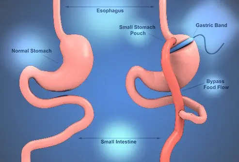 General Surgeon Bariatric