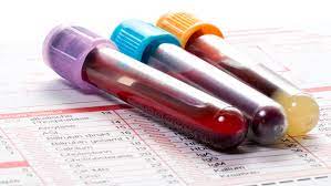 Blood Testing