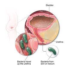 Urinary Tract I