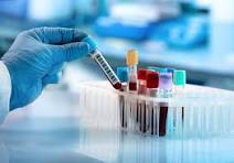 Blood Test