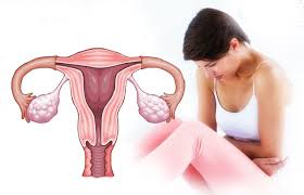 Abnormal vaginal bleeding