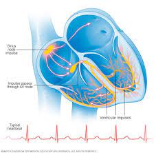 Bradycardia