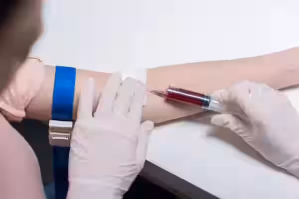Hepatitis Profile, Comprehensive by CLIA Serum Test