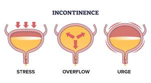 Urinary incontinence