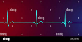 bradycardia heartbeat