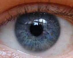 Corneal Blindness