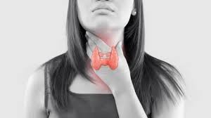 Hypothyroidism