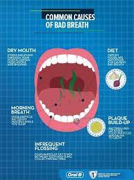 tongue halitosis bad breath